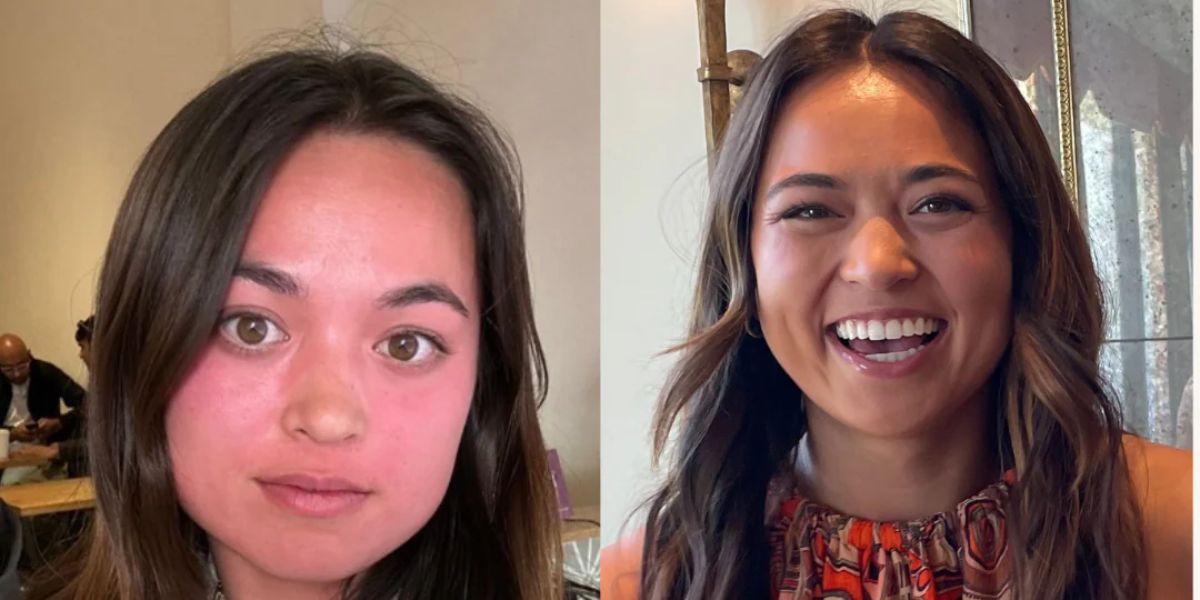 The Asian Glow Patch That Lets You Actually Enjoy the Party Without Flush
