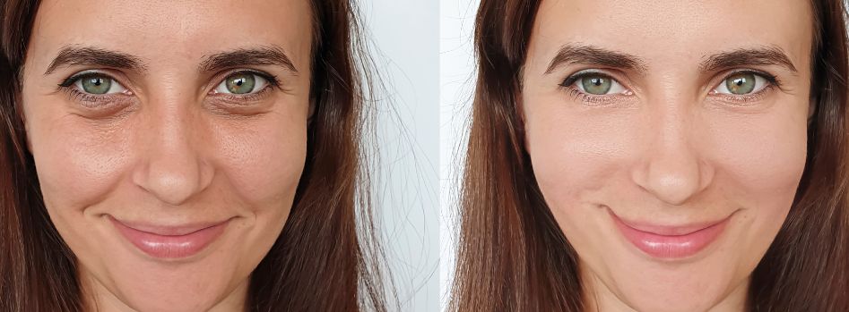 Stop Hiding Your Red Face Try an Asian Glow Pill