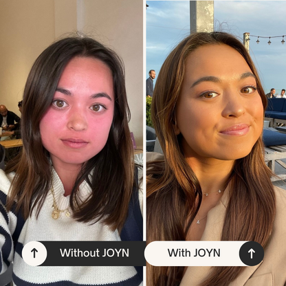 JOYN Before &amp; After